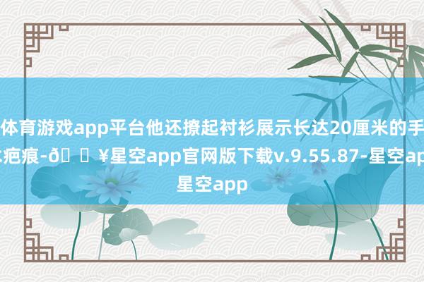 体育游戏app平台他还撩起衬衫展示长达20厘米的手术疤痕-🔥星空app官网版下载v.9.55.87-星空app